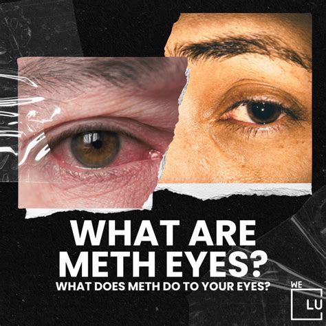 What Are Meth Eyes? What Does Meth Do To Your Eyes?