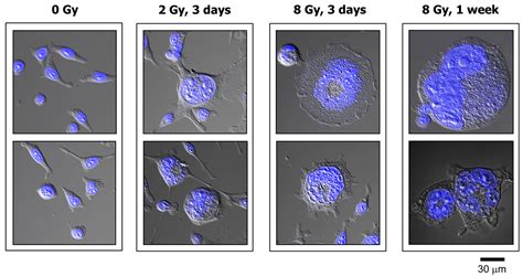 Multinucleated Giant Cancer Cells Produced in Response to Ionizing ...