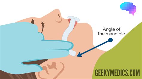 Oropharyngeal Airway Measurement Cephalometric Changes In Pharyngeal