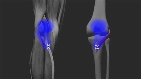 Acupuncture for Popliteus Muscle Pain — Morningside Acupuncture NYC