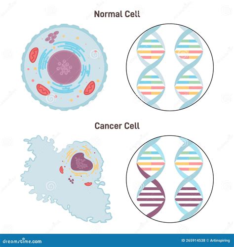 Normal and Cancer Cells. Difference between Healthy Tissue and Tumor Stock Vector - Illustration ...