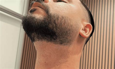 Corinne Aesthetics | Laser & Skin - From $81.90 - Thousand Oaks | Groupon