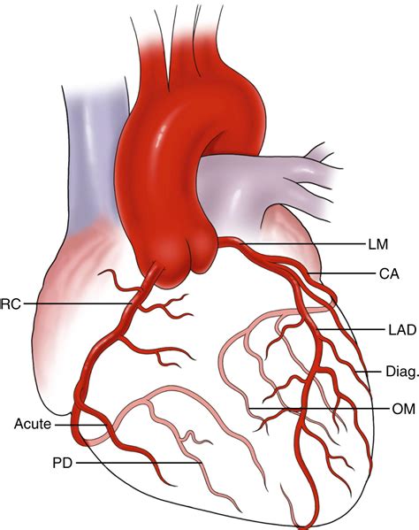 Acquired Heart Disease: Coronary Insufficiency - Clinical Tree