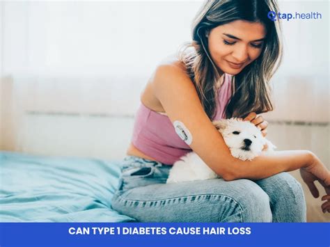 Can Type 1 Diabetes Cause Hair Loss?
