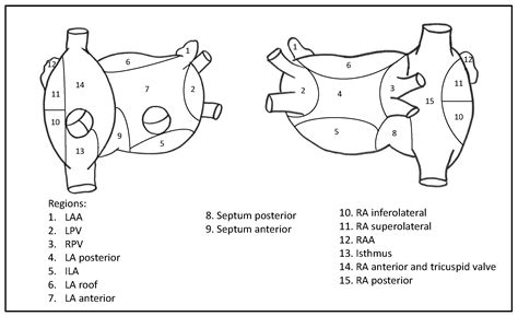 Pulmonary Vein Isolation Followed by Biatrial Ablation of Rotational ...