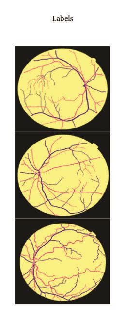Image result for Channel AV Classification