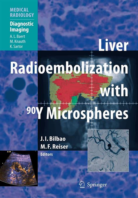 Buy Liver Radioembolization with 90y Microspheres (Medical Radiology ...
