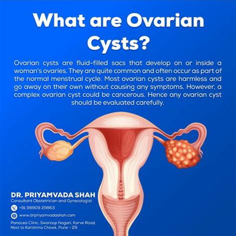 Can Ovarian Cyst Cause Infertility