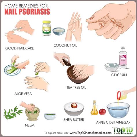treatment for nail psoriasis