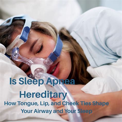 Is Sleep Apnea Hereditary? How Tongue, Lip, and Cheek Ties Shape Your ...