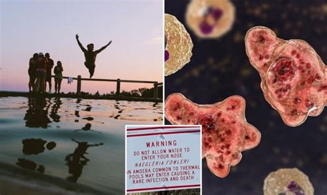 दक्षिण कोरिया में Brain-Eating Amoeba से पहली मौत