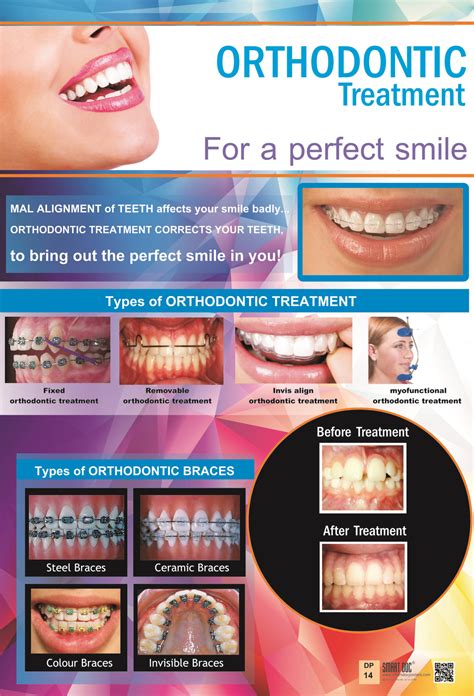 Types of Orthodontic treatment + Different types of braces (Eng.) DP-14 E. | Smart Doc Posters