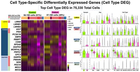 LMNA-Related Dilated Cardiomyopathy: Single-Cell Transcriptomics during Patient-Derived iPSC ...