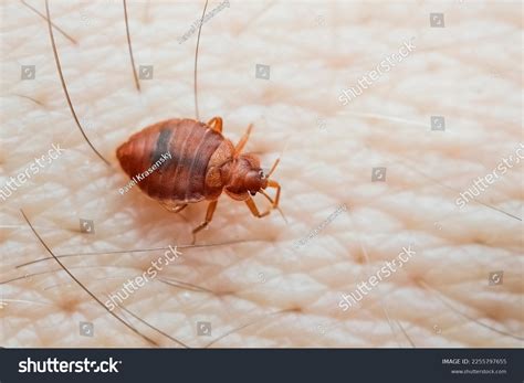 Bed Bugs On Skin
