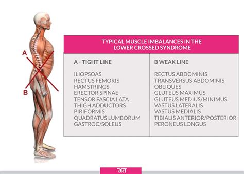 Long Muscles Lower Crossed Syndrome Upper And Lower Cross Syndrome
