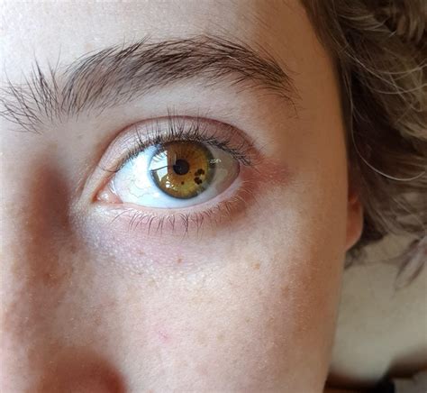 The freckles in my eyes. : r/mildlyinteresting