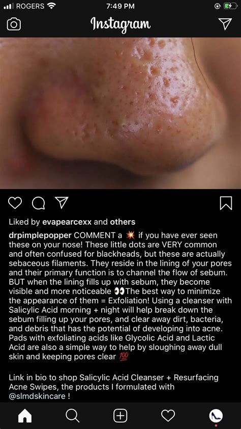 How to treat sebaceous filaments skin care face – Artofit