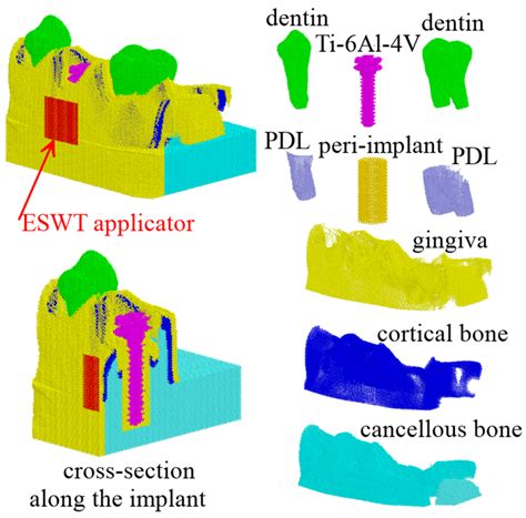Biomechanics of Osseointegration of a Dental Implant in the Mandible ...