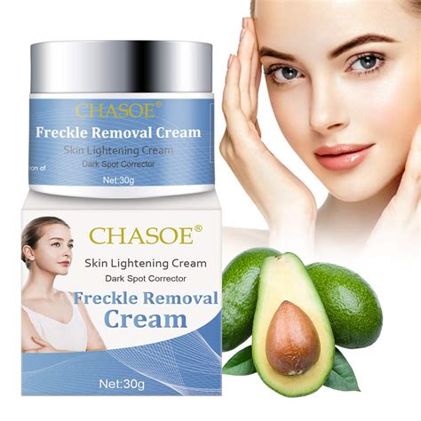 Freckle Removal Cream, Whitening Cream, Lightening Cream, Skin ...