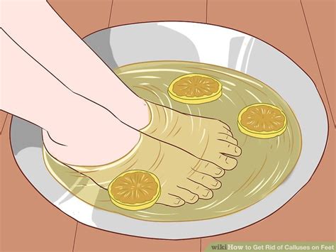 Image result for How to Remove Calluses From Feet Fast