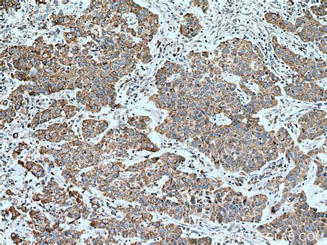 citrate synthase antibody (67784-1-Ig) | Proteintech