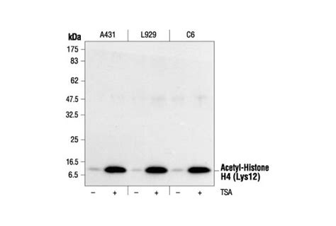 Acetyl-Histone H4 Antibody Sampler Kit - 1 Kit - Zelle Biotech