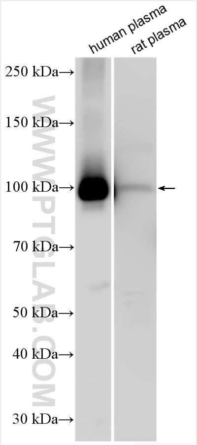 Complement factor B antibody (10170-1-AP) | Proteintech