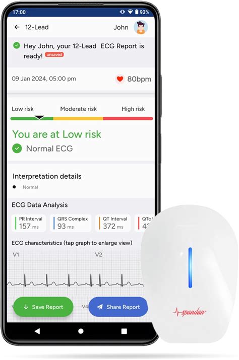 Sunfox Spandan ECG 4.0 with Extra Pack of 100 electrodes | Portable ECG ...