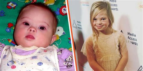 Baby with Down Syndrome Abandoned at Birth Becomes an Actress Years Later