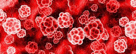 Best Hemato Oncology treatment at Oncoplus Hospital, Delhi