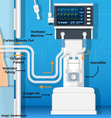 What Is A Ventilator Circuit at Armando Jackson blog