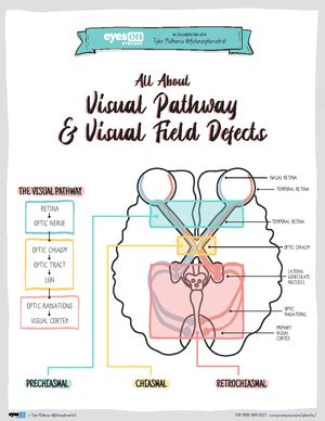 Image result for Visual Pathway Defects
