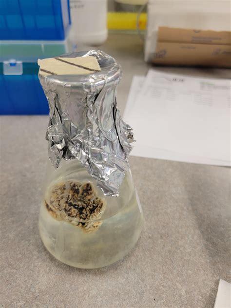 Would anyone happen to know what organism this is? It grew in a flask of YPD -tryptophan media ...