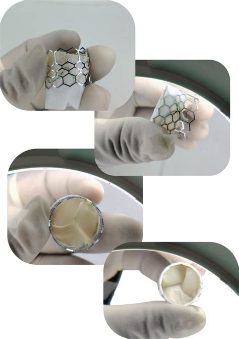 Medical Device Design and Contract Manufacturing | SGMED Pvt. Ltd ...