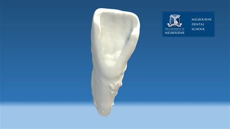 Shovel Shaped Incisors Ancestry at Dean Metoyer blog