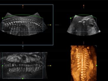 DC-40 - Primary Care Ultrasound Systems - Mindray India