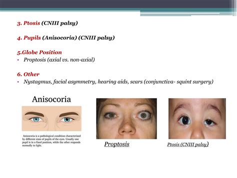 STRABISMUS EXAMINATION.pptx............. | PPTX