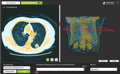 Load File DICOM Viewer 的图像结果