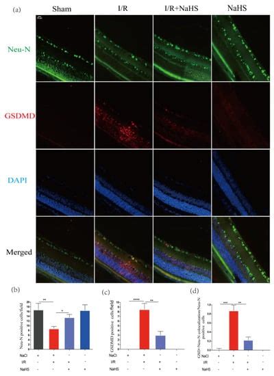 Hydrogen Sulfide Attenuates Neuroinflammation by Inhibiting the NLRP3 ...