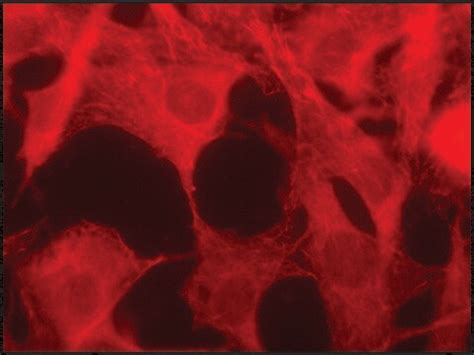 Anti-EB1 antibody produced in rabbit ~1.5 mg/mL, affinity isolated ...