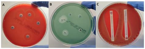 Antimicrobial Susceptibility Testing: A Comprehensive Review of ...