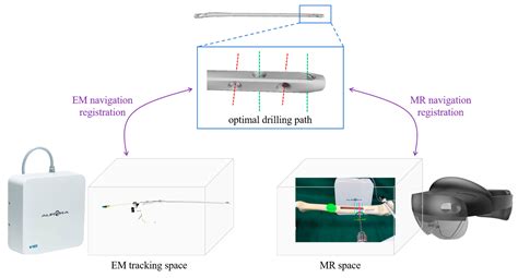 Development and Evaluation of a Novel Mixed Reality-Based Surgical ...