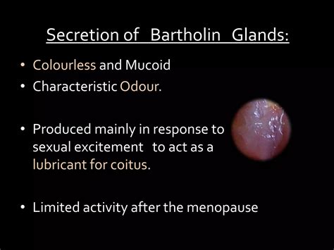 Bartholin gland cyst | PPTX