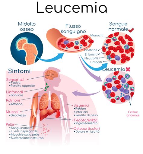 LEUKERAN ® - Foglietto Illustrativo