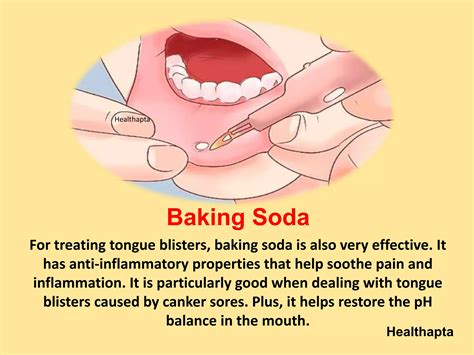 10 Home Remedies for Blisters on Tongue | PPTX | Ear, Nose and Throat Conditions | Diseases and ...