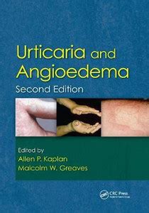 Urticaria and Angioedema: Buy Urticaria and Angioedema by unknown at ...