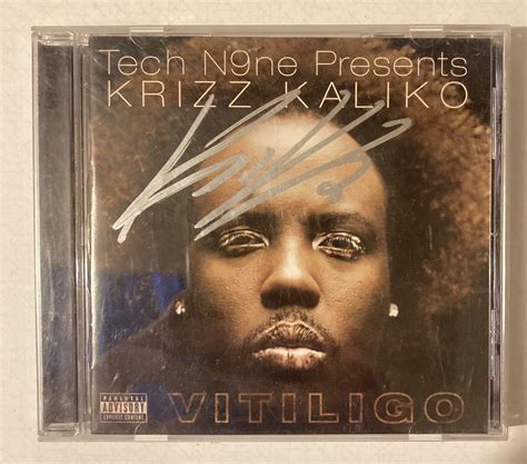 Krizz Kaliko Vitiligo 17 Famous People With Vitiligo Living Dappled - how rare is vitiligo