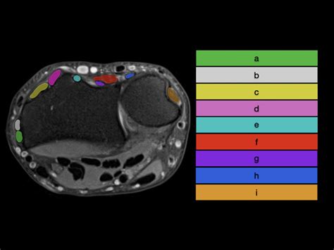 Extensor Pollicis Longus 的图像结果