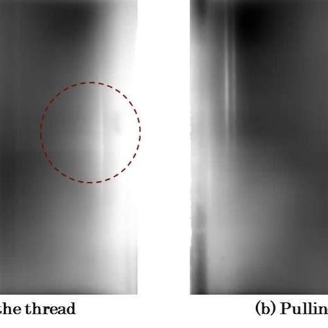 Image result for Transillumination