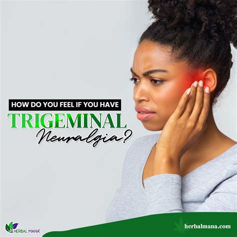 What is trigeminal neuralgia causes symptoms treatment – Artofit
